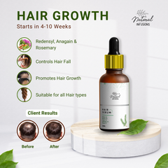 Natural Infusions Hair Growth Serum (50ml) | Redensyl, Anagain, Rosemary, Procapil, & Capila Longa | Controls Hair Fall | Increase Hair Density | For Men and Women | (Pack of 3)