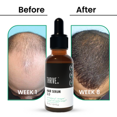 ThriveCo Hair Growth Serum 2.0 - 30 ml